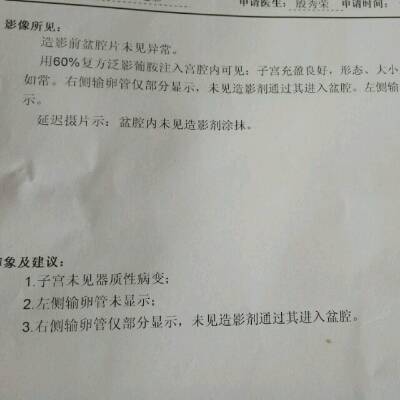 请问我做输卵管造影结果显示1左侧输卵管未显