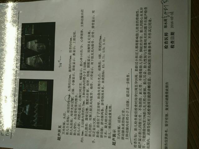 孕六个月,胎动减少帮忙看看_孕六个月胎动减少