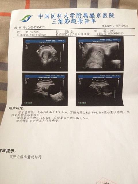 三维彩超,孕酮,这样正常么。好担心呀_我今天