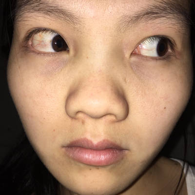 谁能说说方法救救我的眼睛?真的好痛苦!