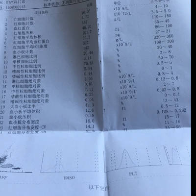 装扮六个多月v鼻涕五天前两天鼻涕痒有点性感睡星的少女途怀孕嗓子图片