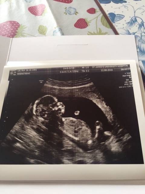 怀孕14周了_怀孕14周宝宝是9.6CM,是男孩还是