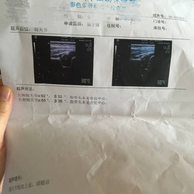 想问一下宝宝42天的时候检查说腿纹不对称 做了b超 医生说的也不是很清楚 这个是不是就说明髋关节不好呢_育儿问答_宝宝树