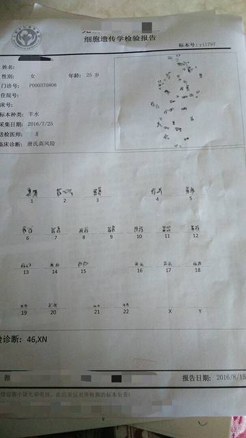 羊水穿刺结果单怎么看呀,上面啥没写_今天取的