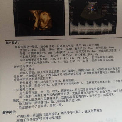 21周照的四维,宝宝长这个样子,能看出来是男宝宝还是女宝宝吗?