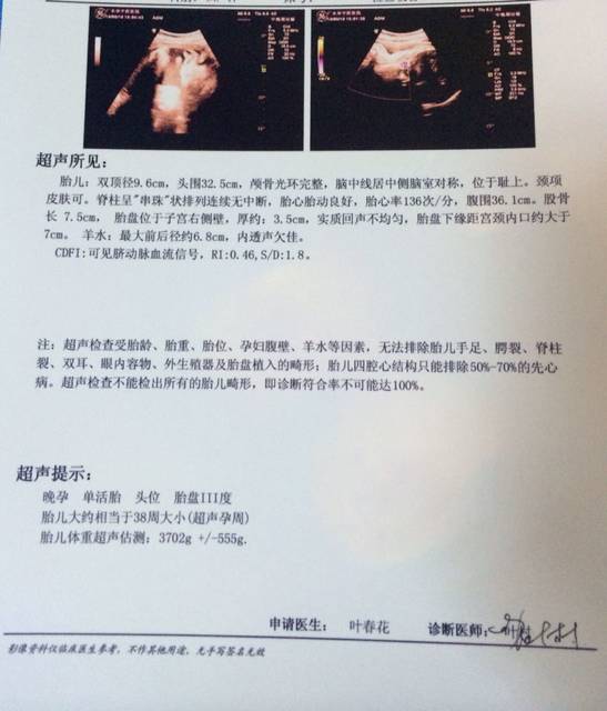 预产期8.19,今天b超说羊水内透性声欠佳,严不严