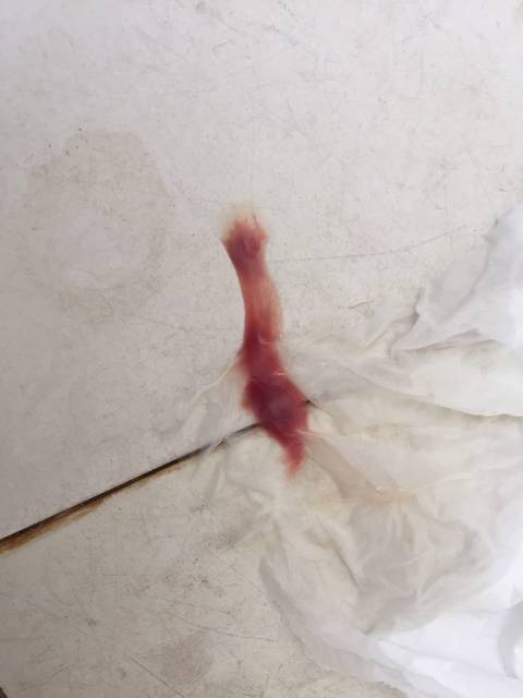 孕38周5天见红没阵痛,是要生了吗?_昨晚很轻