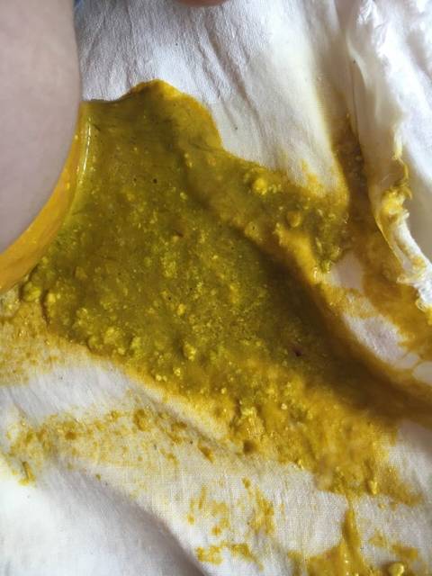 宝宝拉肚子还能打疫苗吗