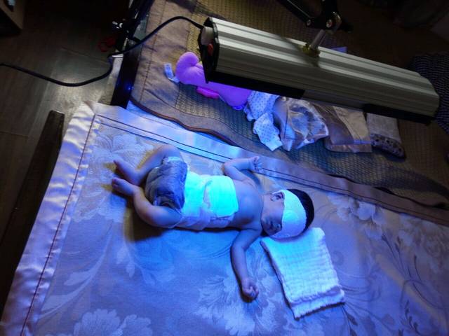 黄疸偏高_黄疸偏高可以自己照蓝光,家用黄疸灯