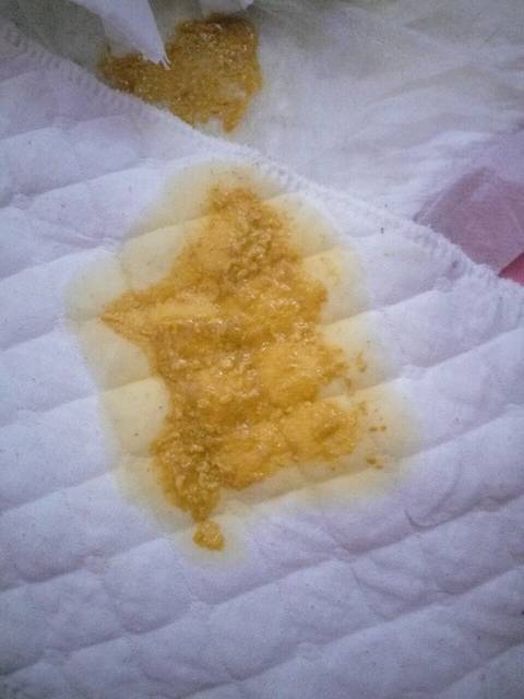 月子期一直拉肚子,宝宝吃母乳也跟着拉_宝宝吃