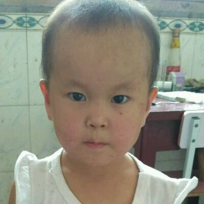 小孩头发长得慢怎么办_育儿问答_宝宝树