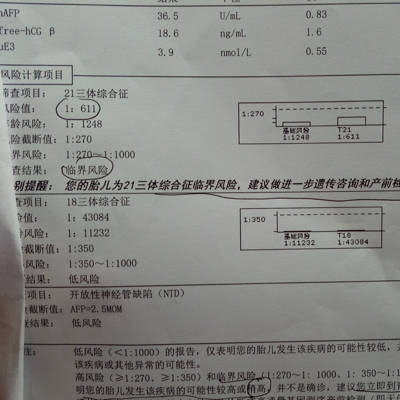 你好,今天唐筛结果出来21三体综合征临界风险,好担心,风险值1:611