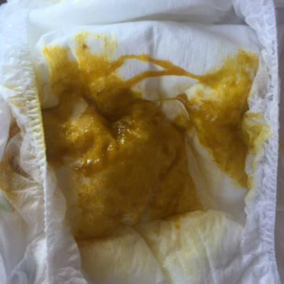 果,香蕉,米粉,后来宝宝便便不好,辅食停了,吃了