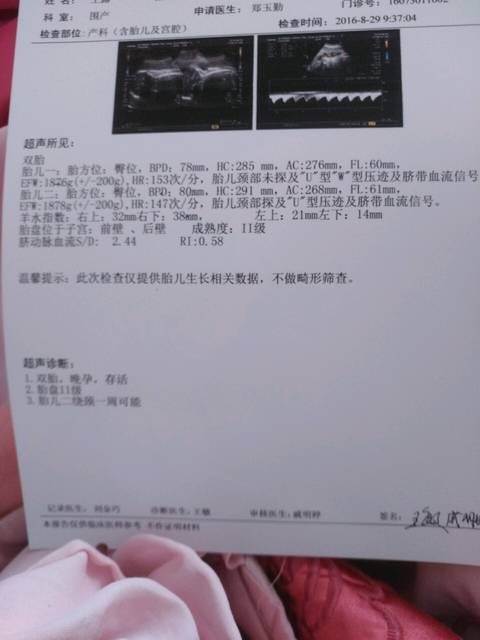 谁知道_双胞胎,有两个胎盘,是同卵还是异卵,谁