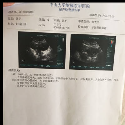 8月16日检查，孕酮47.57绒毛膜促性腺激素2359。然后8月30日去复查，孕酮下降到24.25。绒毛膜促性腺线激素是9340。现在怀孕六周，想咨询要不要保胎_育儿问答_宝宝树