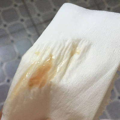 一连就几天都这样,就昨天早上去检查就变白带带渣渣.