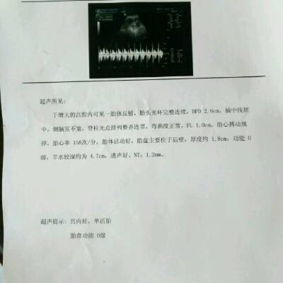 这是彩超单子,谁能帮我看看