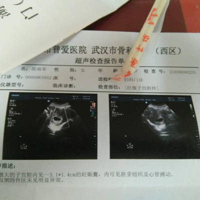 怀孕七周,昨天做了b超,宝宝有心跳了,现在能看的出是男宝还是女宝吗?