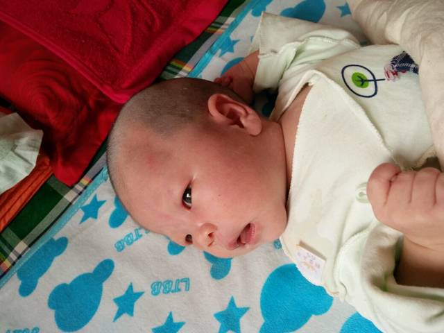 眼皮红怎么回事_宝宝眼皮发红怎么回事_宝宝