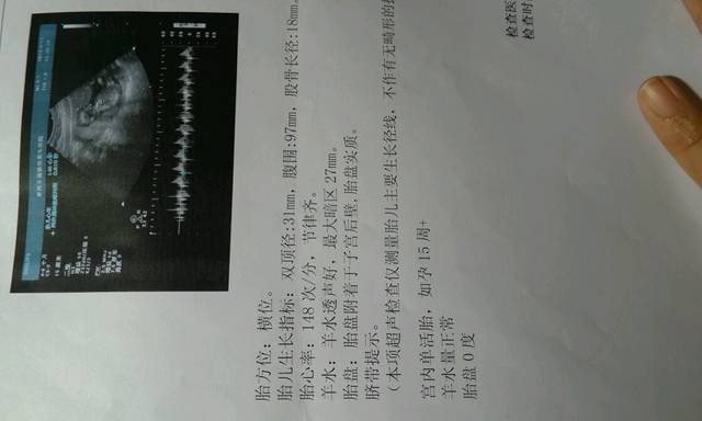 怀孕四个月了,却又检查出衣原体感染,怎么办,要