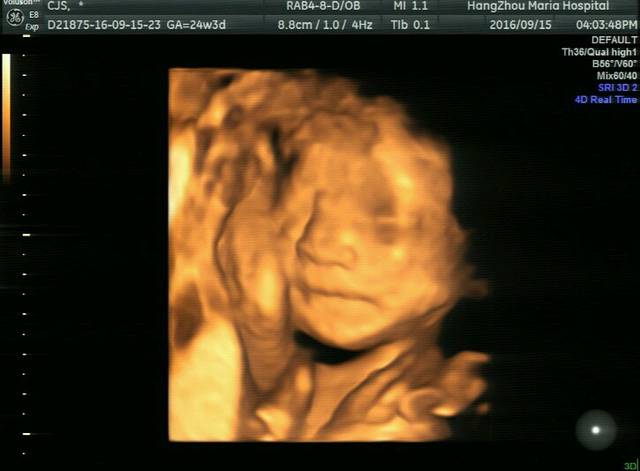 四维接男宝,图片看男女啦,他们说可以看到生殖器,大家娱乐一下