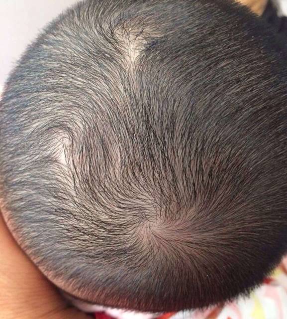 三个旋的宝宝多不多、我女儿居然是三个_不知道有多少宝宝和我女_宝宝树