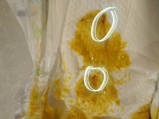 53天的宝宝今天大便发现有红点!_这是什么情况