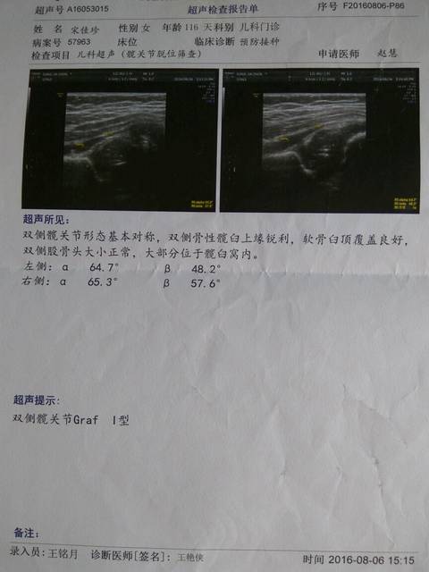 婴儿大腿纹不对称。医生说小腿蹬的挺活跃的没