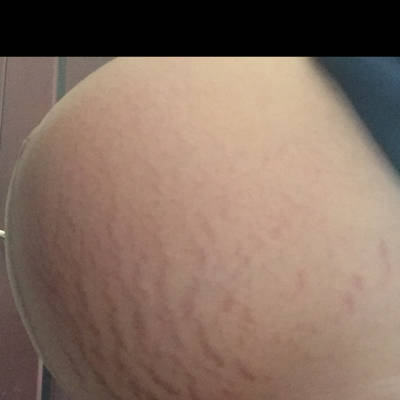 看肚子下坠了没?男宝还是女宝?