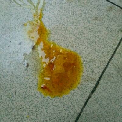 我家宝宝五个月了一直是纯母乳喂养最近两天宝