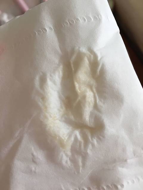 求助。怀孕四周,这是褐色分泌物吗,要紧吗_内