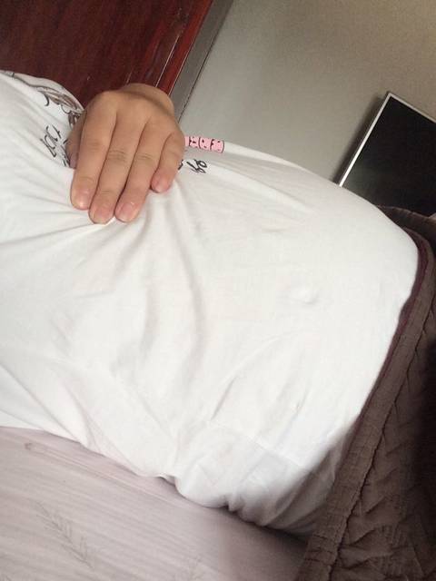 有木有人右胸下面骨头痛呢?_这两天不知道怎