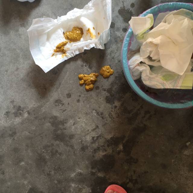 一个星期没有上大便