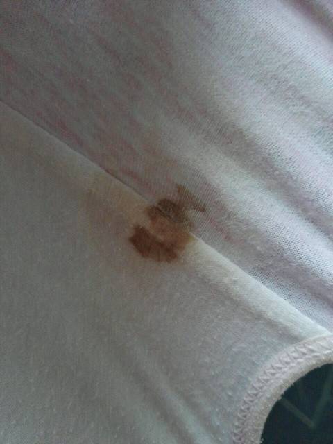 急急啊,孕38周+早上起床有褐色东西流出_大家