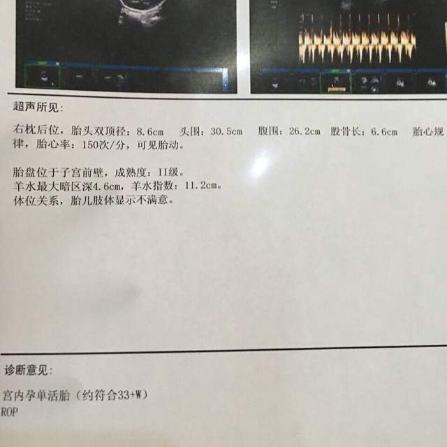 能不能帮我看看孩子正不正常。_孕33周,胎头双