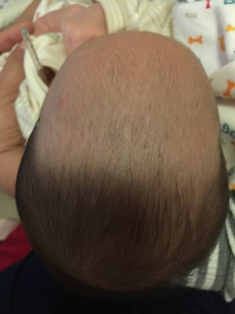28天宝宝不长头发_宝宝28天了 生下来 额头上