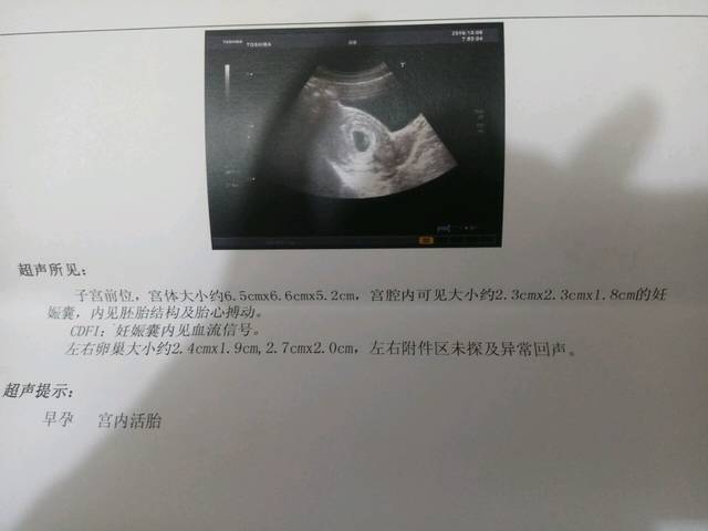 妊娠囊内可见血流信号,是什么意思呀。有没有