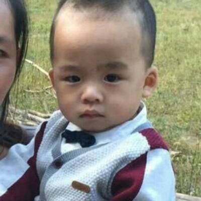 我家宝宝一个耳朵大一个耳朵小怎么办