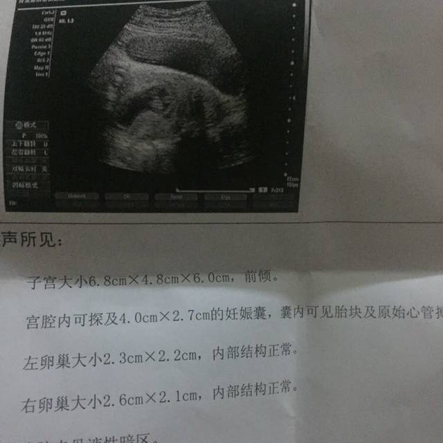 商业保险都一样吗 商业保险包括哪些保险