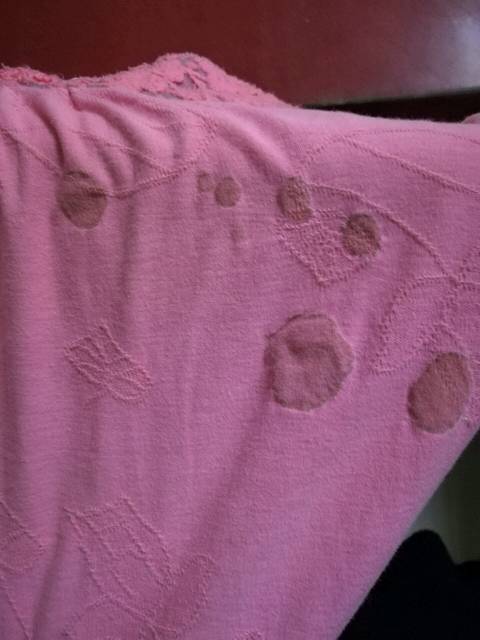 求解_晚上睡觉,早上起来衣服上莫名其妙就有这