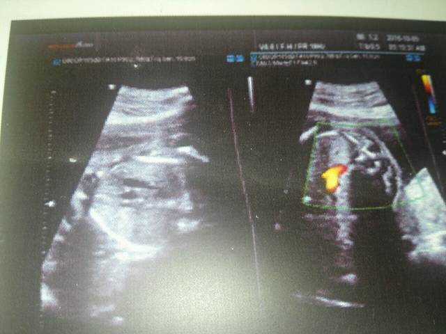 四维看男女_大家都把四维彩超单子发来吧,我同学是医生,她教我_宝宝树