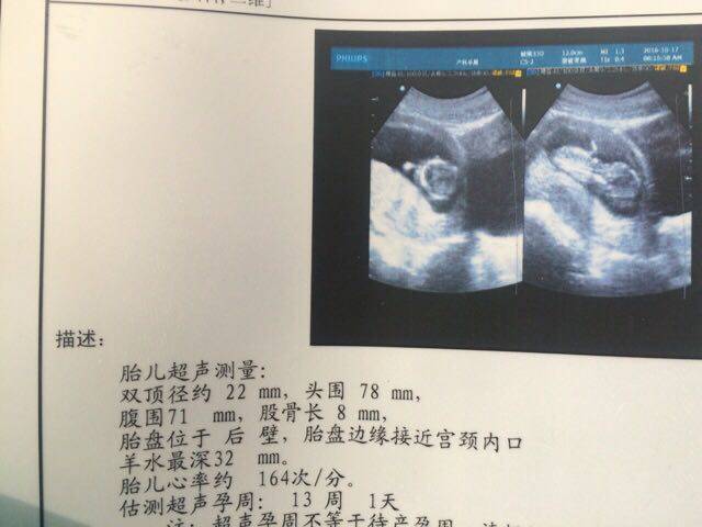 孕12周 ,肚子大小正常吗?