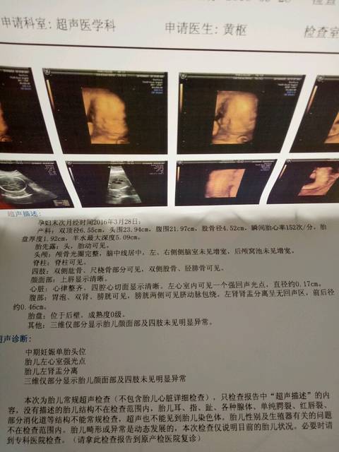 三维报告出来,左肾盂分离是什么意思?_有没有