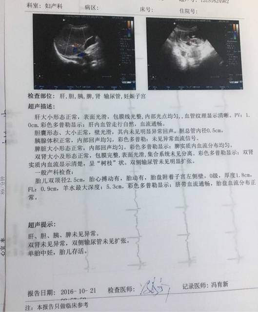 12周建卡B超单双顶径2.5
