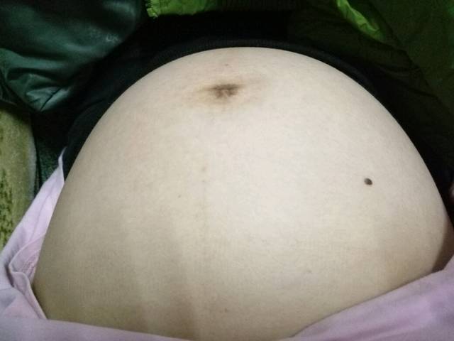 亲们好,_现在怀孕六个多月了,肚脐上有点黑黑