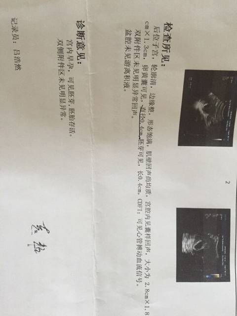 孕期介绍任何v情史,有没有宝妈和我一样呢?是女自己情史没有女生图片