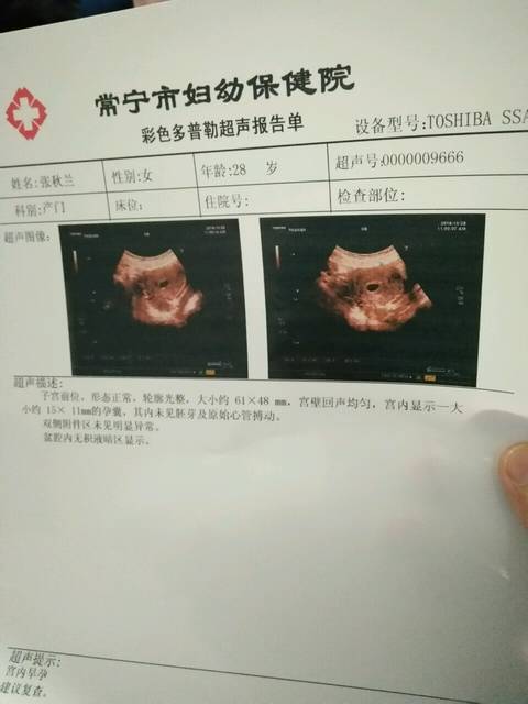 怀孕五十多天b超检查孕囊偏小,没看到胎心胎芽