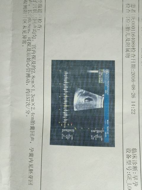 我的怀孕是马上动漫啊?_到底二胎女孩四个月活泼女生男孩图片