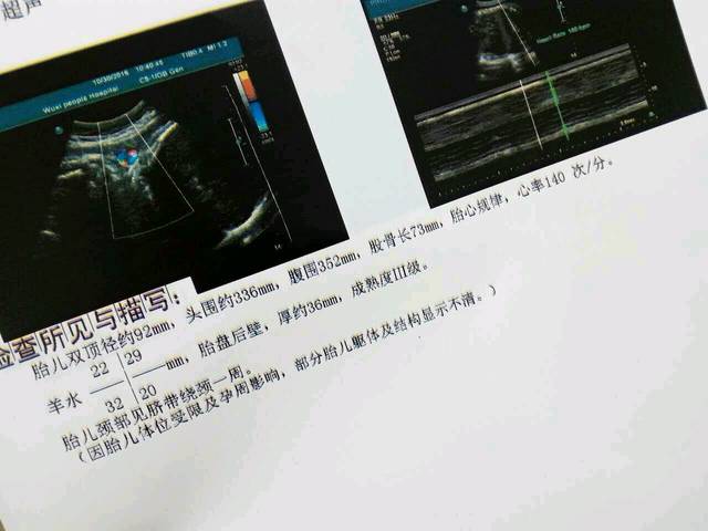 40周B超数据。宝宝还是不出来。着急_宝宝双