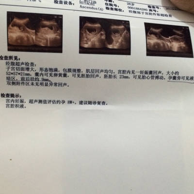 男宝吧,你早期时候孕囊是圆形还是椭圆